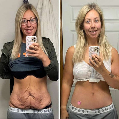 GLP-Parches™ El método que ayuda a reducir el apetito y perder hasta 10 libras en 30 días