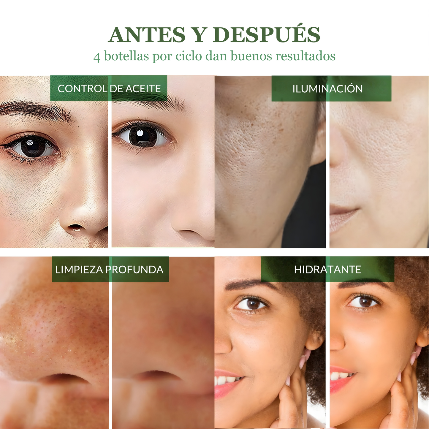 Oryon|¡Elimina puntos negros e impurezas en sólo 10 minutos!