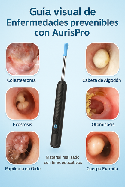 AurisPro: Control visual, Cuidado sin miedo.