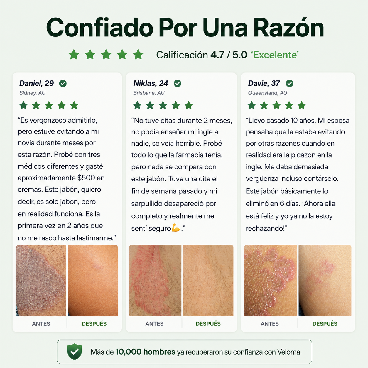 Los hombres que se deshicieron de años de tiña inguinal para siempre no usarán ningún otro producto.