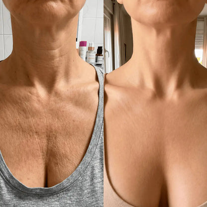 Rellena sin agujas. Sin clínica. K-Glow® · 1+1 GRATIS