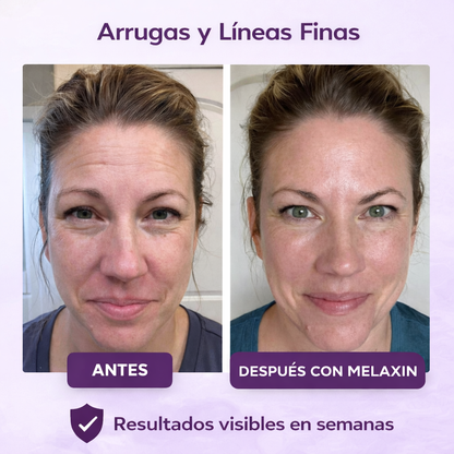 Bálsamo antiarrugas, piel más firme, lisa y luminosa,resultados desde la primera aplicación